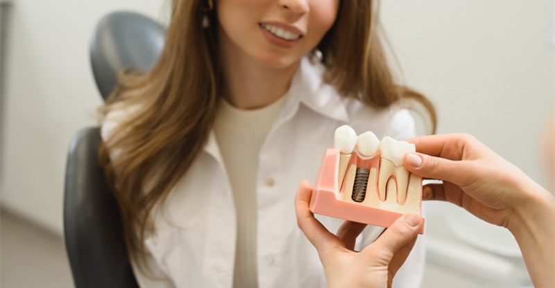care for dental implants and overdentures