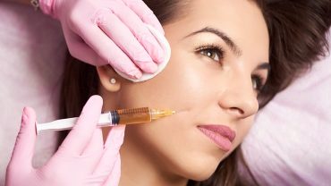 dermal fillers injections