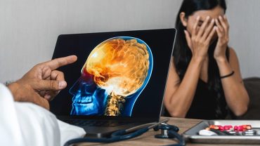 Hiring A Brain Injury Lawyer