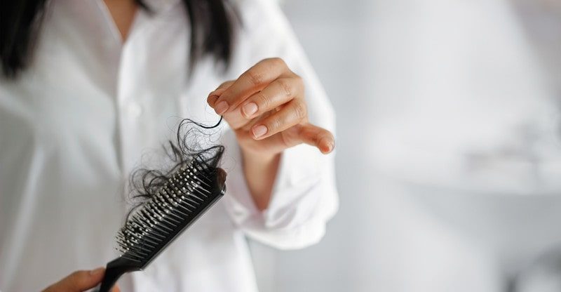 know about hair loss