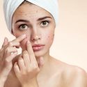 over moisturizing skin