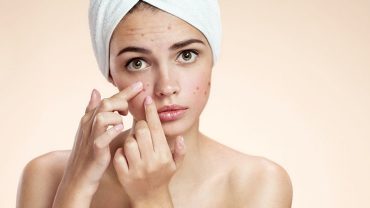 over moisturizing skin